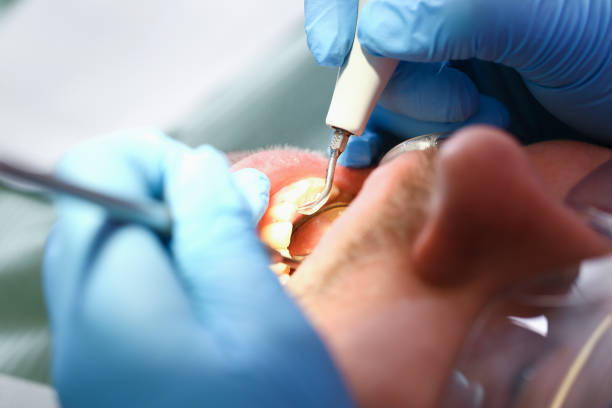 Best Emergency Dental Care for Broken or Chipped Teeth in Kulpmont, PA