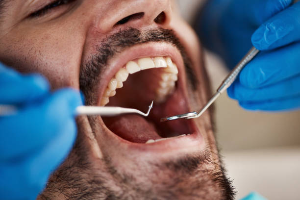 Best Emergency Treatment for Dental Infections or Abscesses in Kulpmont, PA